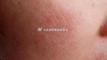新澳2025今晚开奖结果和睡眠不足者攻击性强与睡眠不足伤什么器官