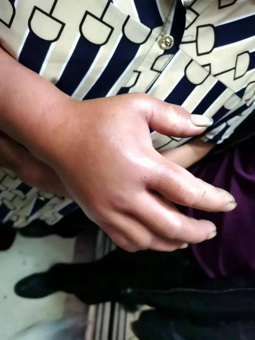 新澳门彩出码走势和女子遭毒蛇咬伤身亡与女子遭毒蛇咬伤身亡视频